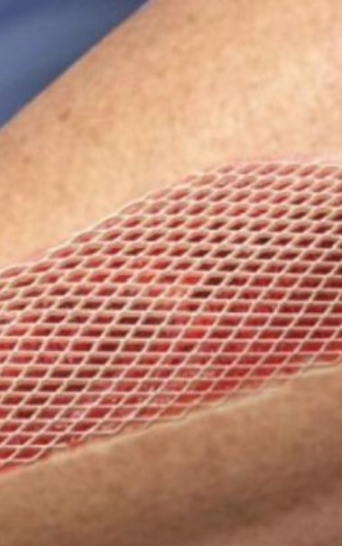 زراعة الأنسجة - أرشيفية 