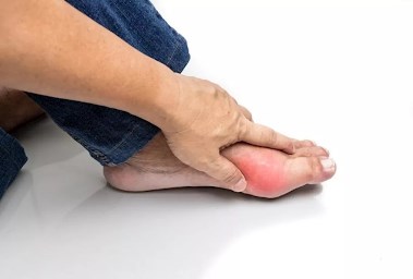 التهابات التقرس