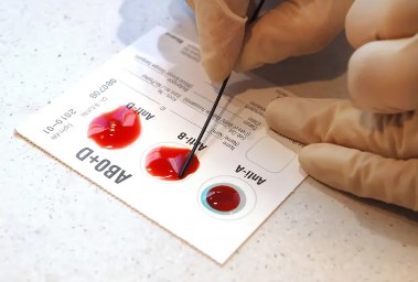 فصائل الدم- تعبيرية