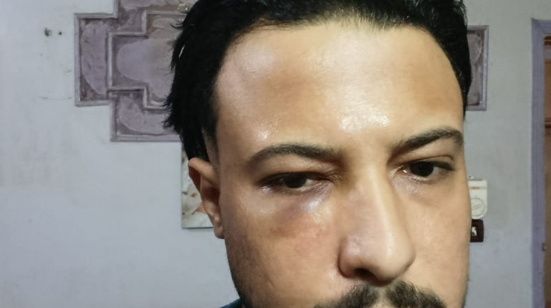 المطرب أحمد ماهر بعد التعدي عليه 