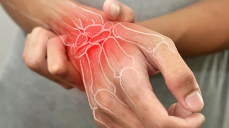 التهاب المفاصل