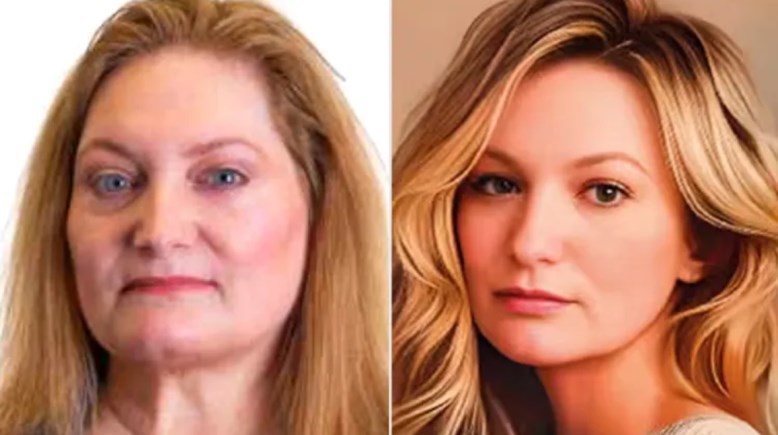 باتريشيا رايخمان قبل وبعد التعديل