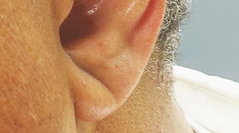 علامة فرانك