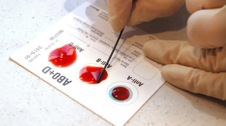 فصائل الدم- تعبيرية