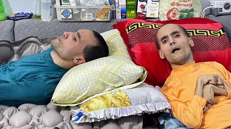 كريم وباسم شقيقان  ضحايا مرض دوشين 