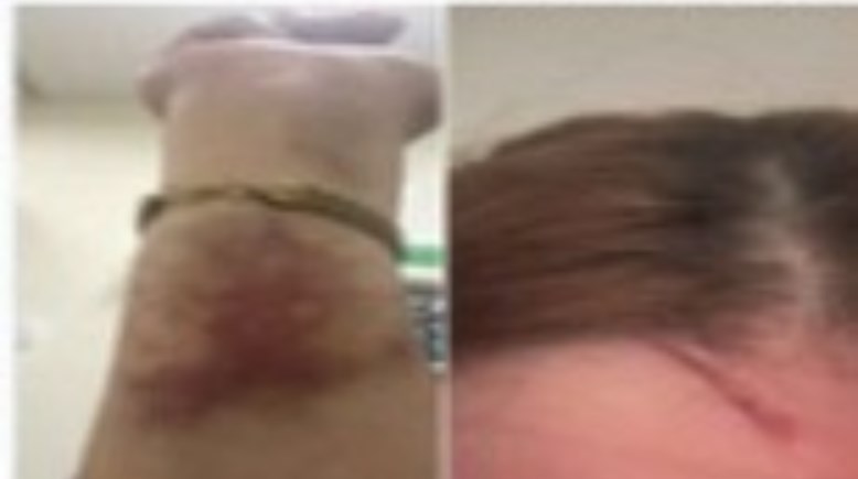 جانب من الواقعة