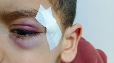 الطفل المصاب