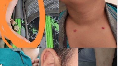 إصابات الطالب