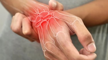 التهاب المفاصل