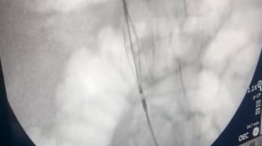 جانب من العملية