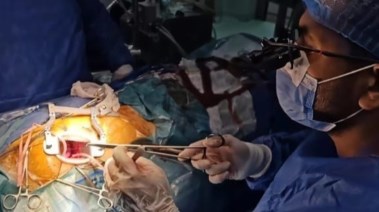 لقطة من التدخل الجراحي