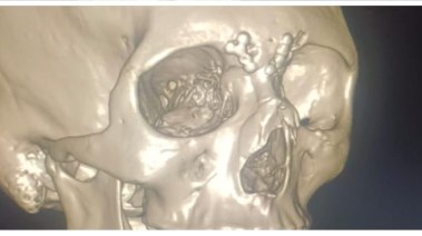 اشعة وجهه المصاب