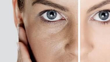 خمس علامات جلدية تدل على تباطؤ عملية الأيض