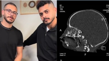 ولادة طفلة البلوجر معاذ الزوزات دون أنف