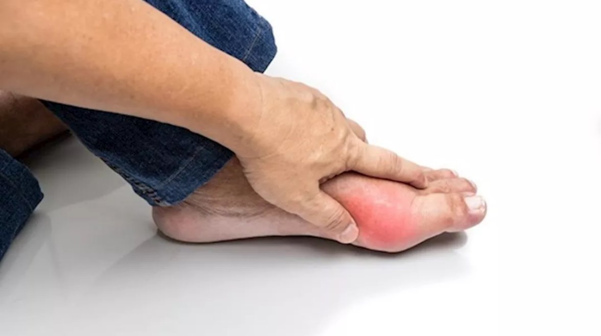 التهابات التقرس