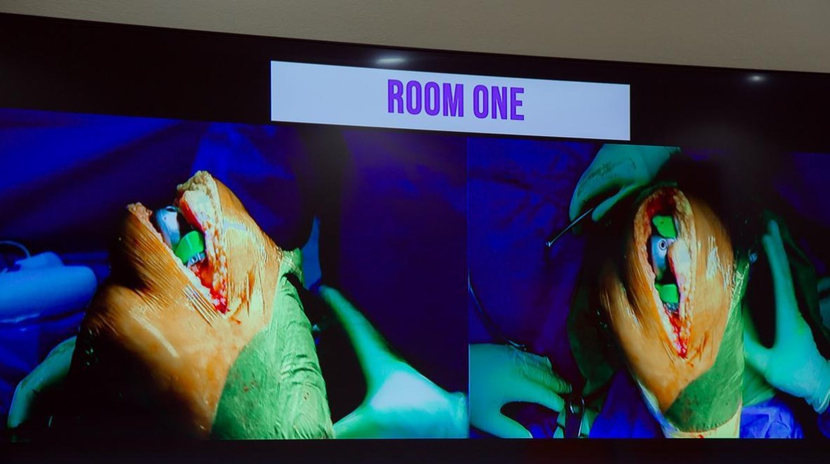 صورة من العمليه