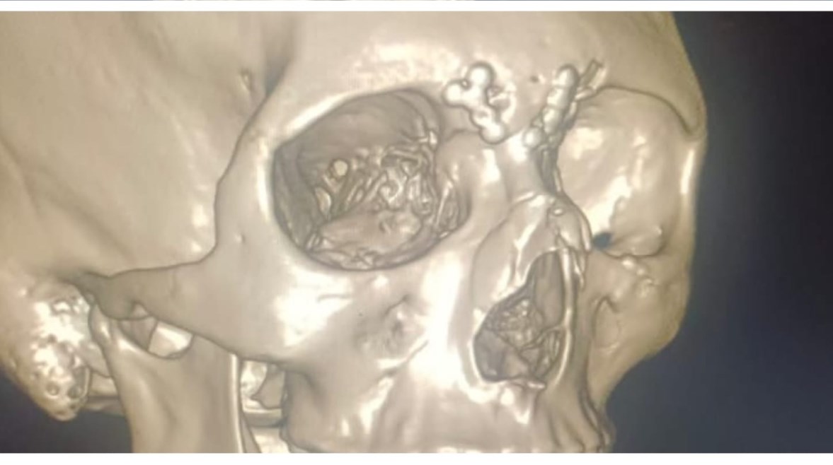 اشعة وجهه المصاب