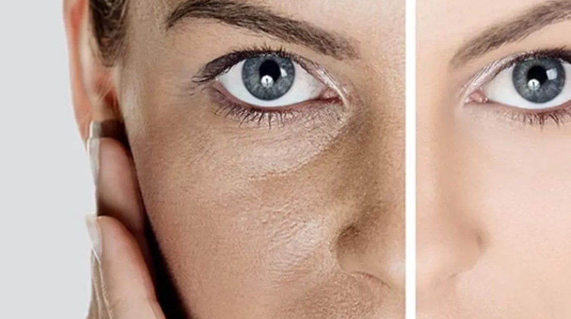 خمس علامات جلدية تدل على تباطؤ عملية الأيض