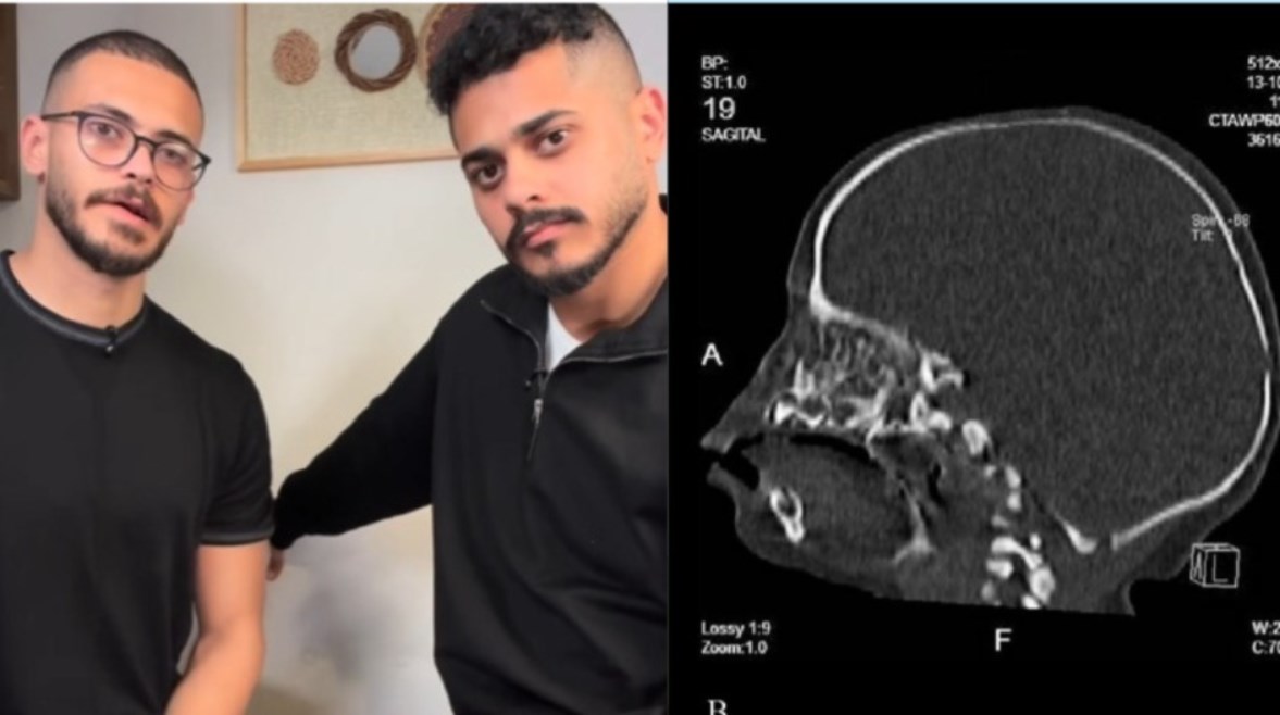 ولادة طفلة البلوجر معاذ الزوزات دون أنف