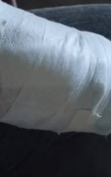 صورة من اصابات الطالب