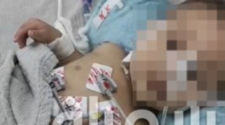 الطفلة رحمة ضحية حقن الكلور من جدتها بالصف