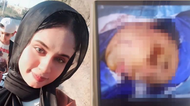 الضحية قبل الحادث وبعده 