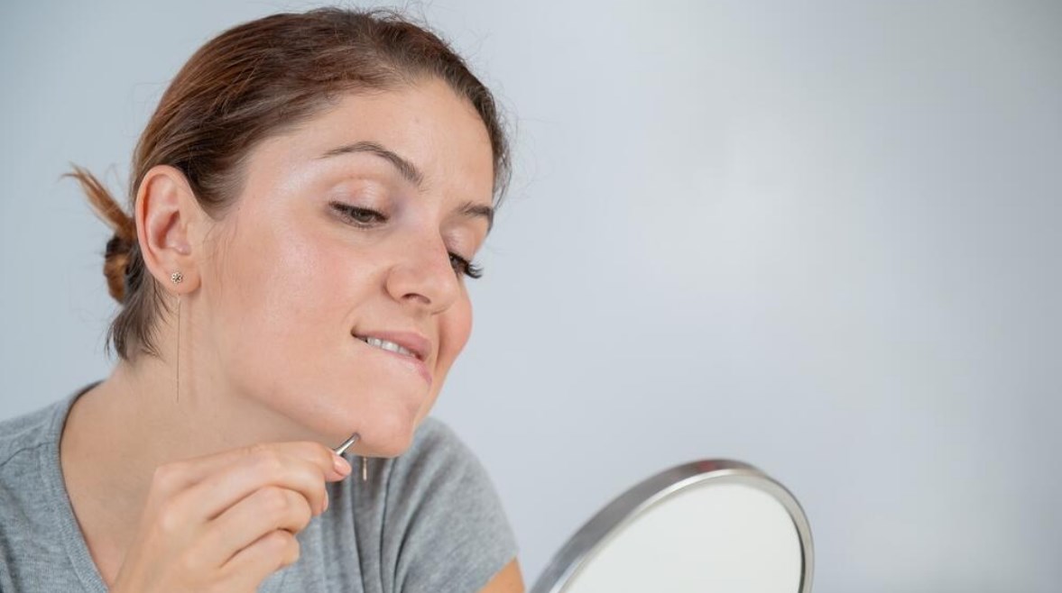 إزالة شعر الذقن