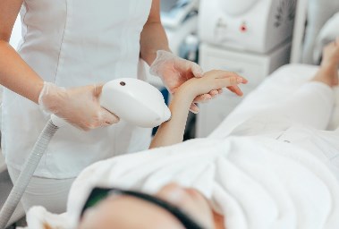 الإصابة بالسنط بسبب الليزر