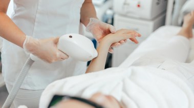 الإصابة بالسنط بسبب الليزر