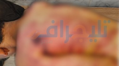 صورة الضحية