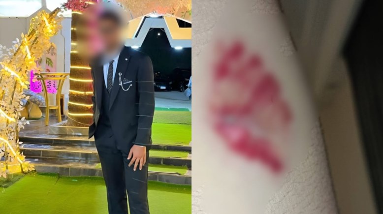 الطبيب ضحية العض