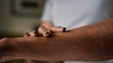 الشعور بالزحف