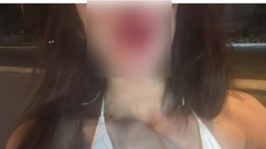 جانب من إصابة السيدة 