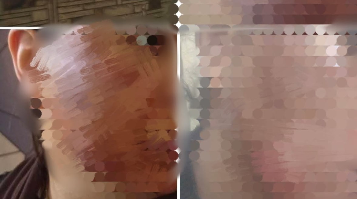 سيدة تتهم عيادة بحرق وجهها 