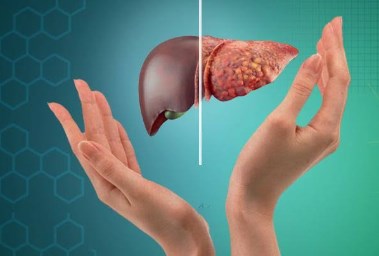 أمراض الكبد المزمنة