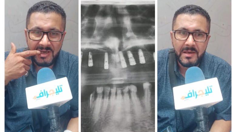 شاب بالبحيرة