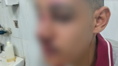 الضحية
