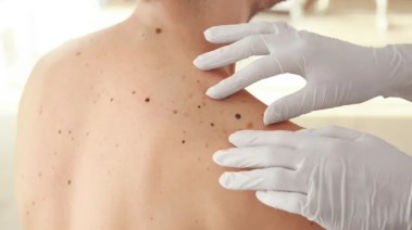 كيف أنقذت جراحة قلب حياة مصاب بالسرطان؟