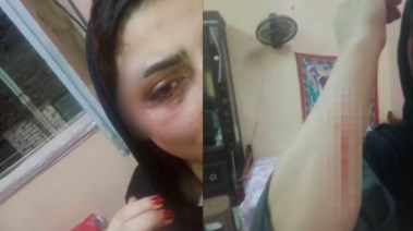 الزوجة المعتدى عليها