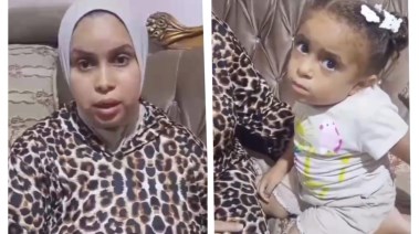 الطفلة المصابة ووالدتها