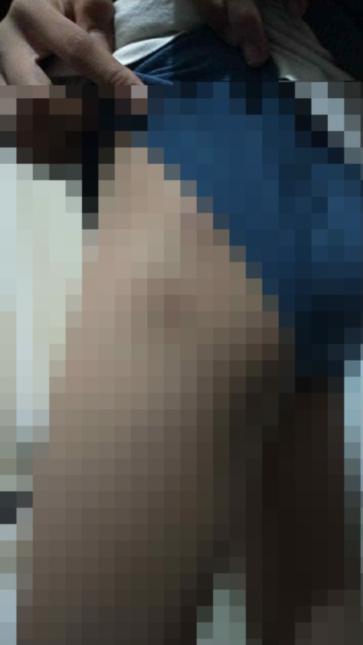 جانب من إصابة الطفل