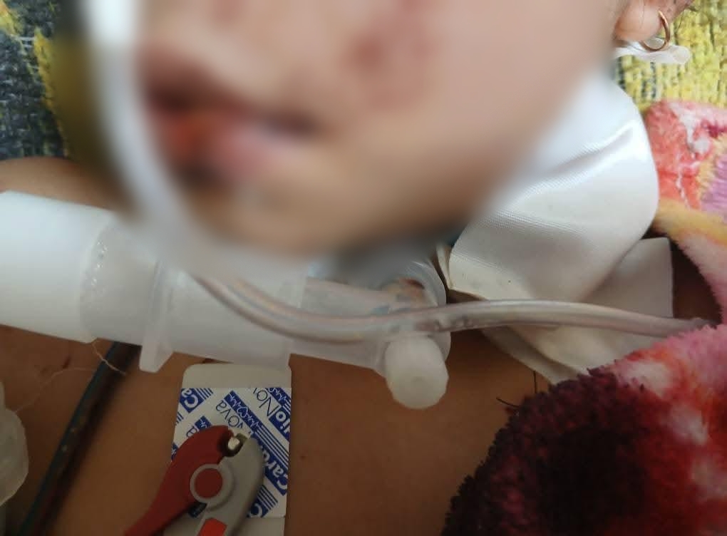 الطفلة إيسل ضحية عمها