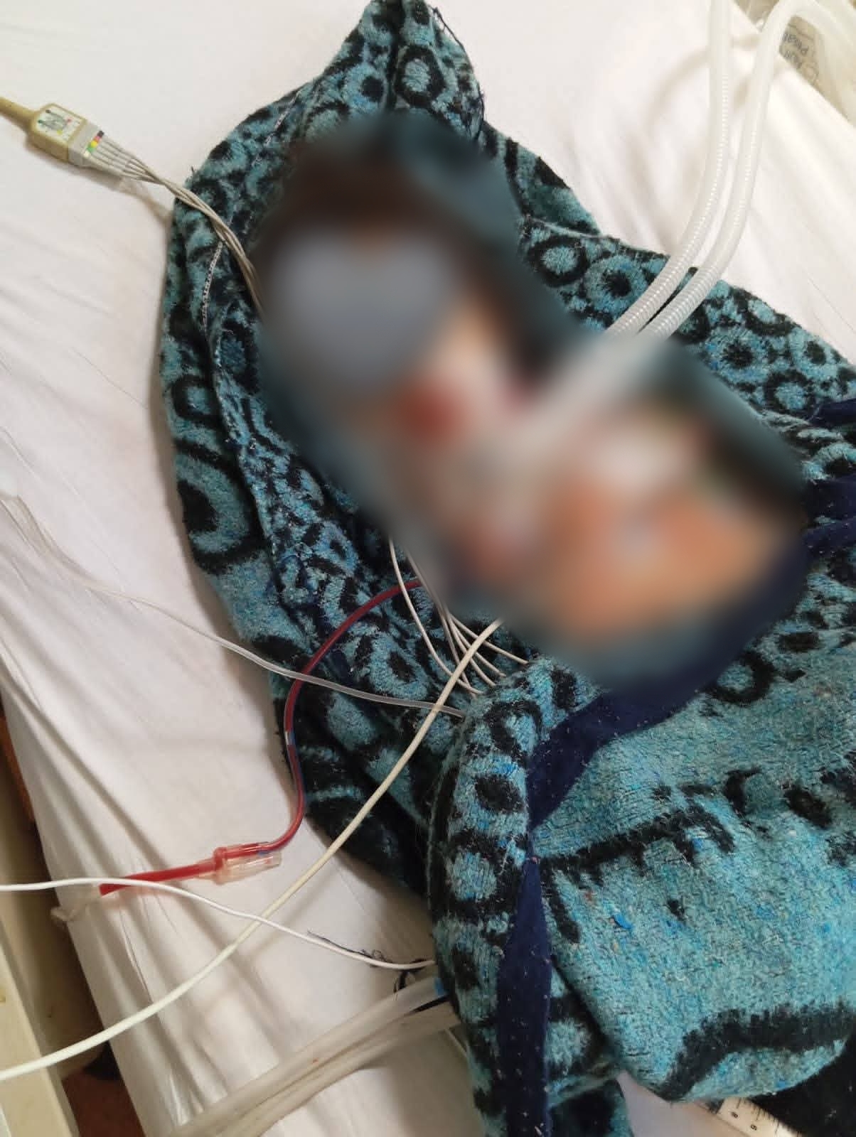 الطفلة أيسل ضحية عمها