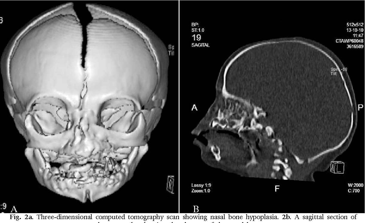 bc882689-5a64-4cf5-b679-8e8281783314 bc882689-5a64-4cf5-b679-8e8281783314