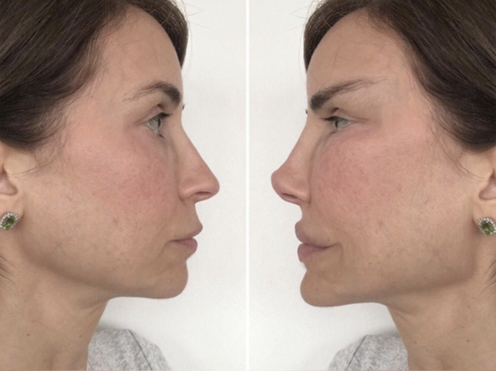 e3c0d09e-c604-4d87-859d-0d2d12bffd7e