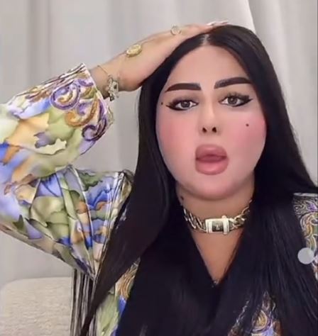 شيماء
